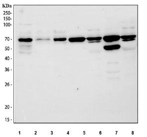 CDT1 Antibody Human, Rat and Mouse WB. Western blot analysis of human HepG2, HeLa, and 293T cell lysates together with rat liver, rat brain, mouse liver, and mouse brain tissue lysates using CDT1 antibody demonstrates detection of a prominent band at approximately 60-70 kDa, consistent with the expected molecular weight of Chromatin Licensing and DNA Replication Factor 1 (CDT1). CDT1 is a DNA replication licensing factor that plays an essential role in pre-replication complex assembly and regulation of genome duplication during cell cycle progression. The observed expression across multiple human, rat, and mouse samples supports the utility of this antibody for studies of DNA replication licensing, cellular proliferation, cell cycle control, and genome stability mechanisms. Predicted molecular weight: ~60 kDa, commonly observed at 60-70 kDa.