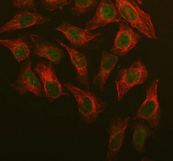 CDT1 Antibody U-2 OS Cell IF. Immunofluorescent staining of FFPE human U-2 OS cells using CDT1 antibody demonstrates predominantly nuclear green fluorescence, consistent with the expected localization of Chromatin Licensing and DNA Replication Factor 1 (CDT1). CDT1 is a DNA replication licensing factor that functions in assembly of the pre-replication complex and regulation of genome duplication during cell cycle progression. Co-staining with Beta Tubulin (red) highlights the cytoskeletal network and provides contrast to the nuclear distribution of CDT1. The observed staining pattern is consistent with the established role of CDT1 in DNA replication licensing, cellular proliferation, and genome stability pathways. HIER: steam section in pH6 citrate buffer for 20 min.
