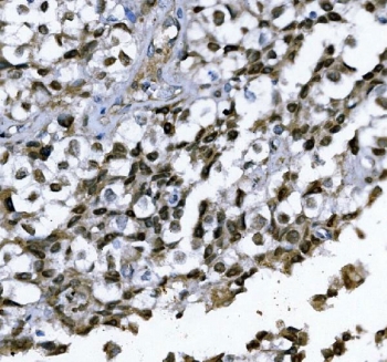 GATA1 Antibody Human Testis IHC. IHC staining of FFPE human testis with GATA1 antibody demonstrated predominantly nuclear staining in spermatogenic cells, consistent with the localization of GATA1 as a zinc finger transcription factor. GATA1 regulates gene expression programs involved in hematopoietic differentiation and has also been implicated in Sertoli cell function and normal testicular development. The nuclear staining pattern reflects its role in transcriptional regulation. HIER was performed by boiling tissue sections in pH 8 EDTA buffer for 20 minutes followed by cooling prior to staining. These results support the utility of GATA1 Antibody for studies of transcriptional regulation, hematopoietic biology, reproductive biology, and developmental biology.
