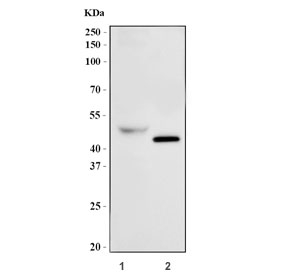 GATA1 Antibody Human K562 and Mouse Testis WB. Western blot analysis of GATA1 expression was performed using anti-GATA1 antibody. Lane 1: human K562 cell lysate. Lane 2: mouse testis tissue lysate. GATA1 is a zinc finger transcription factor that serves as a master regulator of erythropoiesis by controlling genes required for erythroid lineage commitment, hemoglobin synthesis, and red blood cell maturation. In addition to its essential role in hematopoietic development, GATA1 is expressed in Sertoli cells and contributes to normal testicular function. Specific immunoreactive bands are detected at approximately 43 kDa in both samples, consistent with the predicted molecular weight of GATA1. These results support the utility of GATA1 Antibody for studies of hematopoiesis, transcriptional regulation, reproductive biology, and developmental biology.