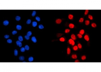 Immunofluorescent staining of FFPE human Caco-2 cells with GATA6 antibody (red) and DAPI nuclear stain (blue). HIER: steam section in pH6 citrate buffer for 20 min.
