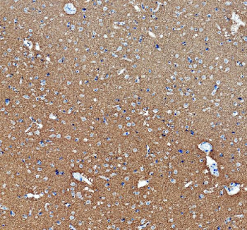 Immunohistochemical staining of FFPE human brain tissue with MAPT antibody, HRP-secondary and DAB substrate. HIER: boil tissue sections in pH8 EDTA for 20 min and allow to cool before testing.