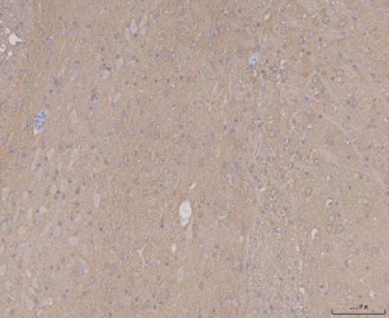Immunohistochemical staining of FFPE rat brain tissue with MAPT antibody, HRP-secondary and DAB substrate. HIER: boil tissue sections in pH8 EDTA for 20 min and allow to cool before testing.