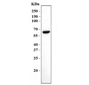 Western blot testing of human HL60 cell lysate with MSL2 antibody. Predicted molecular weight ~63 kDa.