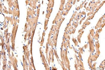 IHC staining of FFPE rat heart tissue with Myosin 6 antibody. HIER: boil tissue sections in pH8 EDTA for 20 min and allow to cool before testing.