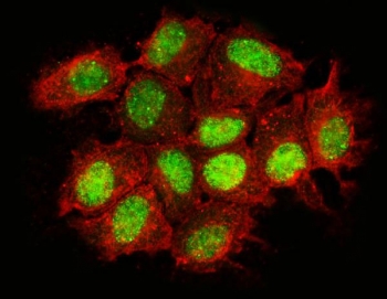 Immunofluorescent staining of FFPE human MCF7 cells with BTBD14B antibody (green) and phalloidin (red). HIER: steam section in pH6 citrate buffer for 20 min.