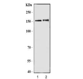 Western blot testing of 1) rat brain and 2) mouse brain tissue lysate with Nitric oxide synthase antibody. Predicted molecular weight ~160 kDa.