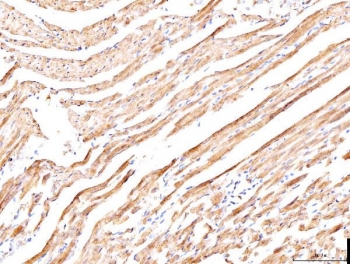 IHC staining of FFPE rat heart tissue with PLB antibody, HRP-secondary and DAB substrate. HIER: boil tissue sections in pH8 EDTA for 20 min and allow to cool before testing.