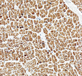 IHC staining of FFPE human heart tissue with PLB antibody, HRP-secondary and DAB substrate. HIER: boil tissue sections in pH8 EDTA for 20 min and allow to cool before testing.