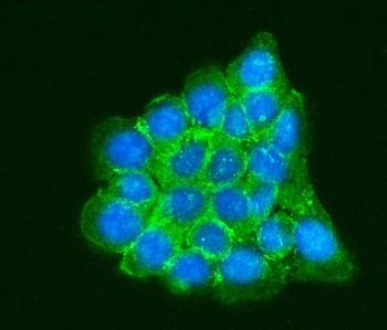 RPLP0 Antibody IF. Immunofluorescent staining of FFPE human A431 cells using RPLP0 Antibody / Ribosomal Protein P0 Antibody demonstrates strong cytoplasmic and perinuclear green fluorescence consistent with the intracellular localization of RPLP0. As a core component of the 60S ribosomal subunit and ribosomal stalk complex, RPLP0 plays an essential role in protein synthesis by facilitating interactions between the ribosome and translation factors required for efficient mRNA translation. The observed staining pattern is consistent with the widespread cytoplasmic distribution expected for a ribosomal protein involved in cellular protein production and translational regulation. Nuclei are counterstained with DAPI (blue). HIER was performed by steaming sections in pH 6 citrate buffer for 20 minutes prior to staining. Green = RPLP0 antibody; Blue = DAPI nuclear stain.