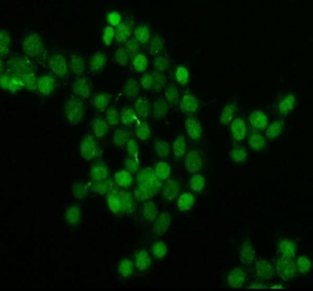 Immunofluorescent staining of FFPE human MCF7 cells with Bromodomain-containing protein 4 antibody.