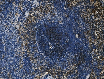 CD4 Antibody for IHC. Immunohistochemistry analysis of CD4 antibody in rat spleen tissue. Formalin-fixed, paraffin-embedded rat spleen shows membranous staining of CD4-positive T helper lymphocytes predominantly localized within the periarteriolar lymphoid sheath (PALS) of the white pulp, with surrounding B cell follicle regions remaining comparatively negative, highlighting compartmentalized immune architecture. Heat-induced epitope retrieval was performed using pH 8 EDTA buffer for 20 minutes followed by cooling prior to antibody incubation.