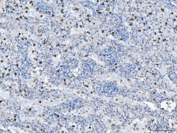 IHC staining of FFPE human spleen tissue with CD14 antibody. HIER: boil tissue sections in pH8 EDTA for 20 min and allow to cool before testing.