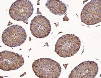 IHC staining of FFPE mouse testis tissue with Calmegin antibody. HIER: boil tissue sections in pH8 EDTA for 20 min and allow to cool before testing.
