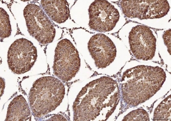 IHC staining of FFPE rat testis tissue with Calmegin antibody. HIER: boil tissue sections in pH8 EDTA for 20 min and allow to cool before testing.