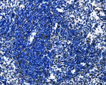 Dectin 1 Antibody Mouse Spleen IHC. Immunohistochemistry of FFPE mouse spleen tissue using Dectin 1 antibody demonstrates punctate HRP-DAB brown staining in scattered myeloid-associated immune cell populations, consistent with Dectin-1 / CLEC7A expression in innate immune cells involved in fungal recognition and inflammatory signaling. HIER: boil tissue sections in pH8 EDTA for 20 min and allow to cool before testing.
