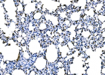 Dectin 1 Antibody Mouse Lung IHC. Immunohistochemistry of FFPE mouse lung tissue using Dectin 1 antibody shows membranous and cytoplasmic HRP-DAB brown staining in scattered immune-associated cells within pulmonary tissue, consistent with Dectin-1 / CLEC7A expression in myeloid populations involved in innate immune surveillance and fungal recognition. HIER: boil tissue sections in pH8 EDTA for 20 min and allow to cool before testing.