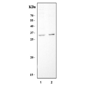 Dectin 1 Antibody Mouse Immune Tissue WB. Western blot analysis of 1) mouse spleen and 2) mouse thymus tissue lysates using Dectin 1 antibody detects bands at approximately 30â35 kDa, consistent with the expected molecular weight range of glycosylated Dectin-1 / CLEC7A, a fungal recognition receptor involved in innate immune and myeloid cell signaling. Apparent molecular weight may vary within the approximately 27â45 kDa range depending on glycosylation state and receptor processing.