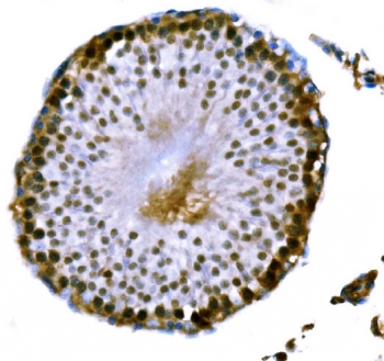 IHC staining of FFPE rat testis tissue with DMC1 antibody. HIER: boil tissue sections in pH8 EDTA for 20 min and allow to cool before testing.
