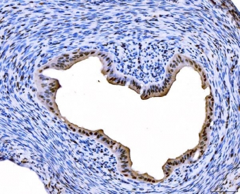 IHC staining of FFPE rat ovary tissue with FOXL2 antibody. HIER: boil tissue sections in pH8 EDTA for 20 min and allow to cool before testing.