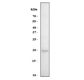 Western blot testing of human MCF7 cell lysate with GADD45B antibody. Predicted molecular weight ~18 kDa.