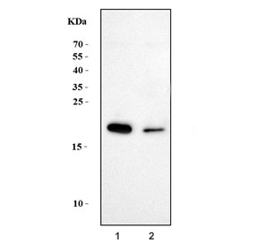 GAST Antibody Caco-2 and Rat Stomach WB. Western blot analysis of 1) human Caco-2 and 2) rat stomach tissue lysates using GAST Antibody detects prominent bands at approximately 16-18 kDa, slightly higher than the predicted molecular weight of mature Gastrin / GAST due to precursor processing intermediates or peptide-associated post-translational modification. This gastric peptide hormone antibody supports detection of gastrointestinal endocrine-associated signaling pathways and Gastrin-related secretory peptide expression within epithelial and gastric tissue compartments.