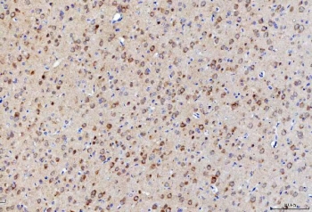 IHC staining of FFPE rat brain tissue with LNPEP antibody. HIER: boil tissue sections in pH8 EDTA for 20 min and allow to cool before testing.