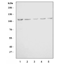 Western blot testing of human 1) HeLa, 2) 293T, 3) Daudi, 4) T-47D and 5) RT-4 cell lysate with LNPEP antibody. Predicted molecular weight ~117 kDa.