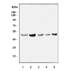 Western blot testing of 1) human HepG2, 2) human MCF7, 3) human SiHa, 4) monkey COS-7 and 5) mouse HEPA1-6 cell lysate with MLX antibody. Predicted molecular weight ~33 kDa, commonly observed at 30-50 kDa.