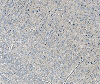 NEDD4 Antibody Rat Brain IHC Neuronal Cytoplasmic Staining. Immunohistochemistry analysis of Neural precursor cell expressed developmentally down-regulated protein 4 / NEDD4 in FFPE rat brain tissue using NEDD4 Antibody for IHC. HRP-DAB brown chromogenic staining demonstrates cytoplasmic localization in neuronal cell bodies distributed throughout the tissue, with lighter background signal in surrounding neuropil and minimal staining in non-neuronal regions. The staining pattern supports neuronal expression of NEDD4 within brain tissue architecture. HIER: boil tissue sections in pH8 EDTA for 20 min and allow to cool before testing.