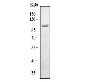Western blot testing of human RT-4 cell lysate with NLRP7 antibody. Predicted molecular weight ~112 kDa.