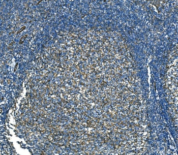 IHC staining of FFPE human tonsil tissue with RAB13 antibody. HIER: boil tissue sections in pH8 EDTA for 20 min and allow to cool before testing.