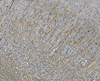 IHC staining of FFPE rat brain tissue with RAB13 antibody. HIER: boil tissue sections in pH8 EDTA for 20 min and allow to cool before testing.