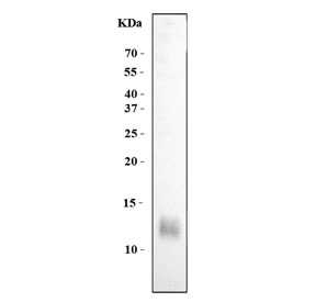 Western blot testing of human MCF7 cell lysate with Estrogen Inducible Protein pS2 antibody. Predicted molecular weight ~12 kDa.