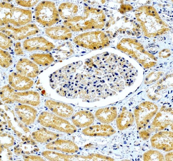 IHC staining of FFPE human kidney tissue with GDP-L-fucose synthase antibody, HRP-secondary and DAB substrate. HIER: boil tissue sections in pH8 EDTA for 20 min and allow to cool before testing.