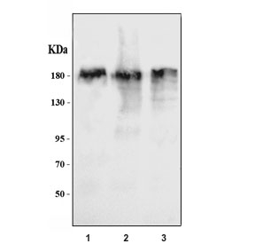 Western blot testing of human 1) K562, 2) HEL and 3) A549 cell lysate with ZNF609 antibody. Predicted molecular weight ~151 kDa.