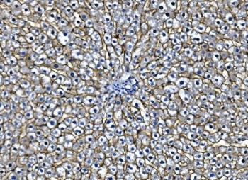 Egf receptor Antibody Rat Liver IHC. Immunohistochemistry staining of FFPE rat liver with Egf receptor antibody. HIER: boil tissue sections in pH8 EDTA for 20 min and allow to cool before testing.