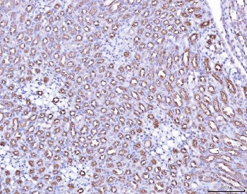 ACP3 Antibody Mouse Kidney IHC. Immunohistochemistry staining of FFPE mouse kidney tissue with ACP3 antibody. HIER: boil tissue sections in pH8 EDTA for 20 min and allow to cool before testing.