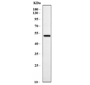 ACP3 Antibody WB. Western blot testing of human MCF7 cell lysate with ACP3 antibody. Expected molecular weight: 45-50 kDa.