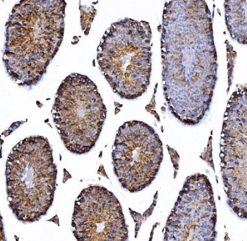 IHC staining of FFPE mouse kidney tissue with HGF-regulated tyrosine kinase substrate antibody. HIER: boil tissue sections in pH8 EDTA for 20 min and allow to cool before testing.