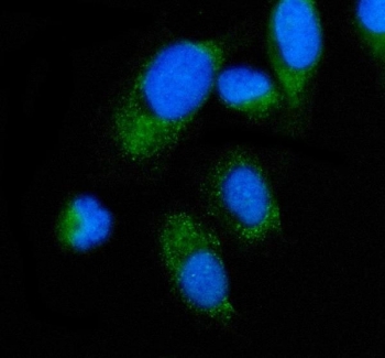 ALAS2 Antibody IF. Immunofluorescent staining of FFPE human PC-3 cells using ALAS2 Antibody / Erythroid Heme Biosynthesis Enzyme Antibody demonstrates granular cytoplasmic green fluorescence with enrichment in a perinuclear distribution, consistent with the mitochondrial localization of ALAS2. ALAS2 is a mitochondrial enzyme that catalyzes the first and rate-limiting step of heme biosynthesis, initiating the pathway required for production of heme and subsequent hemoglobin synthesis. The observed cytoplasmic staining pattern is consistent with localization of ALAS2 within intracellular mitochondrial compartments involved in cellular metabolic activity and heme production. Nuclei are counterstained with DAPI (blue). HIER: steam section in pH 6 citrate buffer for 20 minutes. Green = ALAS2 antibody; Blue = DAPI nuclear stain.