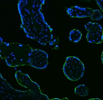Immunofluorescence of Placental Alkaline Phosphatase Antibody Clone 6C7G3 in human placenta. Formalin-fixed, paraffin-embedded human placental tissue demonstrates strong membranous fluorescence in syncytiotrophoblastic cells (green), outlining chorionic villi structures. Nuclei are counterstained with DAPI (blue). Heat-induced epitope retrieval was performed by boiling tissue sections in pH 8 EDTA buffer for 20 min followed by cooling prior to antibody incubation.