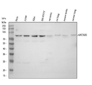 TEM8 Antibody Human, Rat and Mouse WB. Western blot analysis of TEM8 Antibody / Tumor Endothelial Marker Antibody detected a major band at approximately 80 kDa, consistent with the reported migration of glycosylated ANTXR1 despite a predicted molecular weight of 63 kDa. Lane 1: human HeLa; Lane 2: human A549; Lane 3: human SiHa; Lane 4: human SH-SY5Y; Lane 5: rat testis; Lane 6: rat lung; Lane 7: mouse testis; Lane 8: mouse lung lysate. The membrane was incubated with TEM8 antibody at 0.5 ug/ml followed by an HRP-conjugated secondary antibody. This TEM8 Antibody, a tumor endothelial marker antibody, detects endogenous ANTXR1 across human, rat and mouse samples.