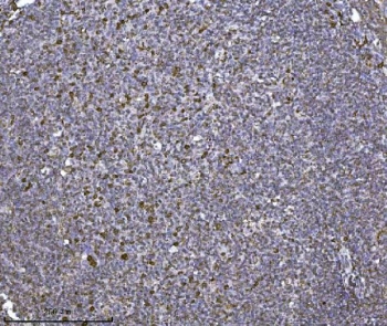 IHC staining of FFPE human tonsil tissue with SCA2 antibody. HIER: boil tissue sections in pH8 EDTA for 20 min and allow to cool before testing.