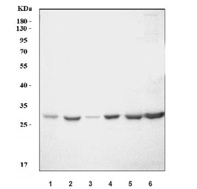 Western blot testing of 1) rat spleen, 2) rat thymus, 3) rat lung, 4) rat L6, 5) rat PC-12 and 6) mouse B16 cell lysate with Cd70 antibody. Predicted molecular weight ~21 kDa but may be observed at up to ~80 kDa due to glycosylation.