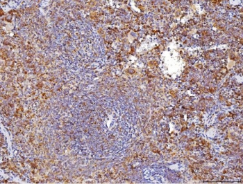Immunohistochemistry of CD70 antibody in FFPE mouse spleen tissue. Mouse spleen demonstrates membranous and cytoplasmic HRP-DAB brown staining in activated lymphoid cells within splenic follicles and periarteriolar lymphoid regions, consistent with CD70 expression in activated T and B cell populations. This CD70 Antibody Rabbit Polyclonal was used following heat-induced epitope retrieval by boiling tissue sections in pH 8 EDTA buffer for 20 minutes and allowing sections to cool prior to staining.