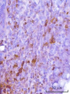 IHC staining of FFPE rat colon tissue with Cdc2 related protein kinase 2 antibody. HIER: boil tissue sections in pH8 EDTA for 20 min and allow to cool before testing.
