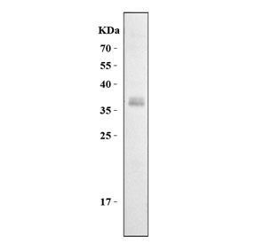 CD7 Antibody for Rodent WB. Western blot analysis of rat thymus lysate shows a band at approximately 25-40 kDa, consistent with the predicted molecular weight of CD7 and reflecting glycosylation-dependent migration of this membrane protein, aligning with the known enrichment of CD7 in thymocytes during T cell development.