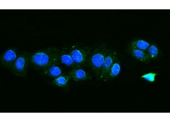 Immunofluorescent staining of FFPE human MCF7 cells with FIS1 antibody (green) and DAPI nuclear stain (blue). HIER: steam section in pH6 citrate buffer for 20 min.