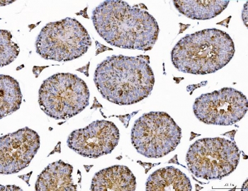 IHC staining of FFPE mouse testis tissue with AHSA1 antibody. HIER: boil tissue sections in pH8 EDTA for 20 min and allow to cool before testing.